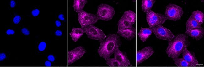 GCN2 Antibody in Immunocytochemistry (ICC/IF)