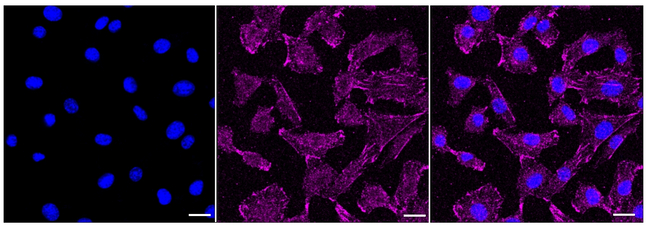 ELP4 Antibody in Immunocytochemistry (ICC/IF)