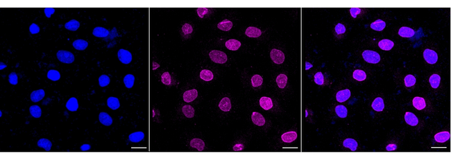 Emerin Antibody in Immunocytochemistry (ICC/IF)