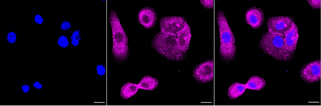EphB1 Antibody in Immunocytochemistry (ICC/IF)