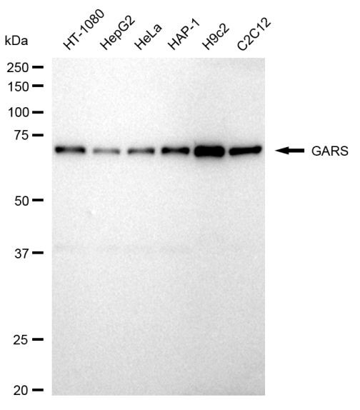 GARS Antibody in Western Blot (WB)