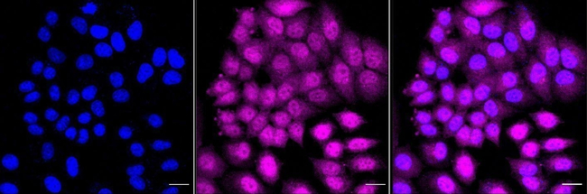 GCLM Antibody in Immunocytochemistry (ICC/IF)