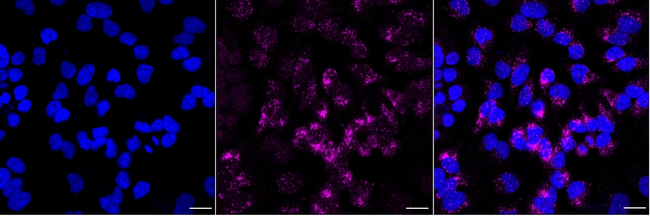 alpha Galactosidase Antibody in Immunocytochemistry (ICC/IF)