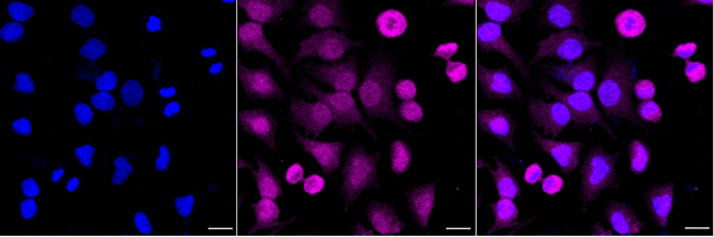 GLO1 Antibody in Immunocytochemistry (ICC/IF)
