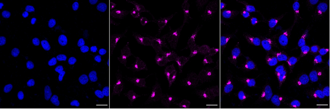 GPI Antibody in Immunocytochemistry (ICC/IF)