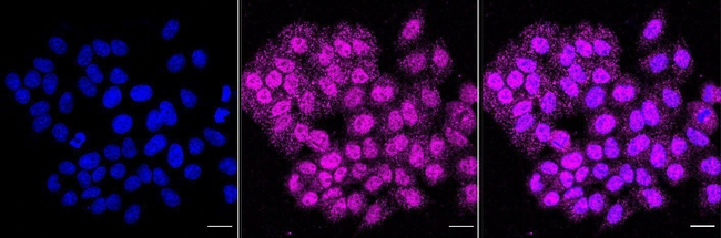 CNTNAP1 Antibody in Immunocytochemistry (ICC/IF)