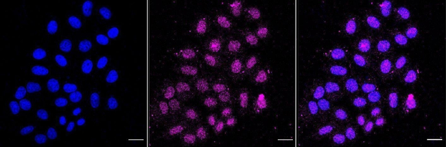 TCEB2 Antibody in Immunocytochemistry (ICC/IF)