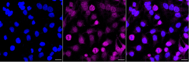 TCEB2 Antibody in Immunocytochemistry (ICC/IF)