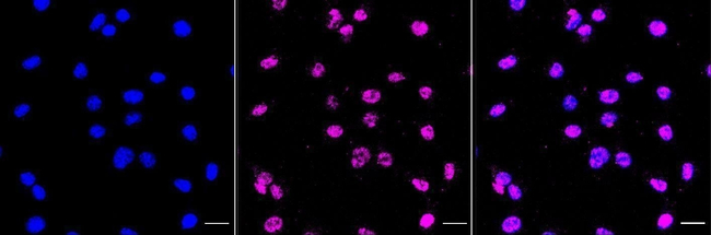 beta-2 Microglobulin Antibody in Immunocytochemistry (ICC/IF)