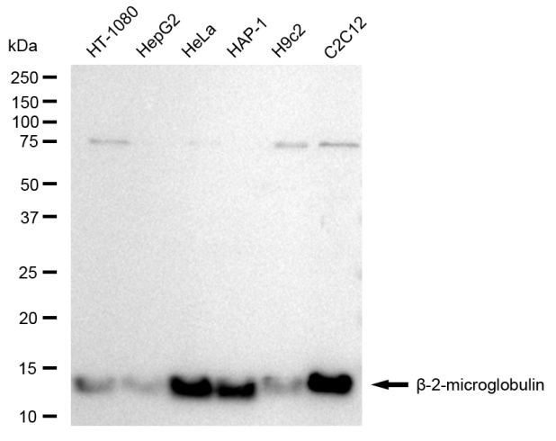 beta-2 Microglobulin Antibody in Western Blot (WB)