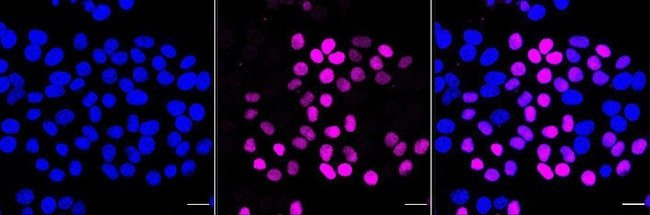 CDT1 Antibody in Immunocytochemistry (ICC/IF)