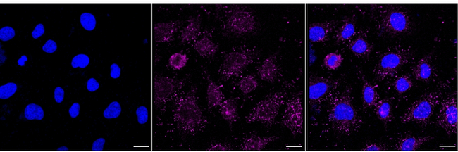PIST Antibody in Immunocytochemistry (ICC/IF)