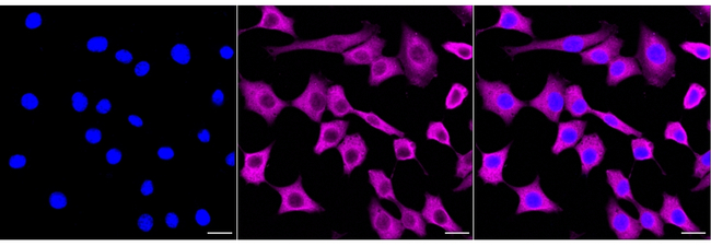 Galectin 1 Antibody in Immunocytochemistry (ICC/IF)