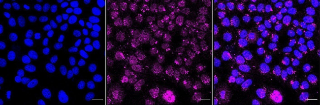 H-Ras Antibody in Immunocytochemistry (ICC/IF)