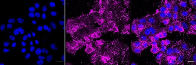HDAC6 Antibody in Immunocytochemistry (ICC/IF)
