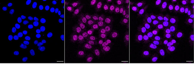 IDE Antibody in Immunocytochemistry (ICC/IF)