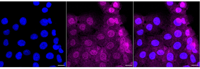 GRB2 Antibody in Immunocytochemistry (ICC/IF)