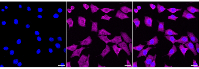 Galectin 1 Antibody in Immunocytochemistry (ICC/IF)