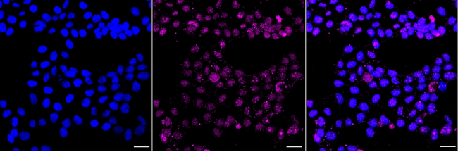 GSTP1 Antibody in Immunocytochemistry (ICC/IF)
