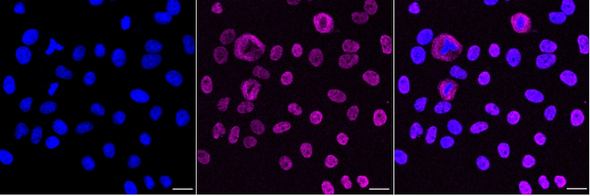 KHSRP Antibody in Immunocytochemistry (ICC/IF)