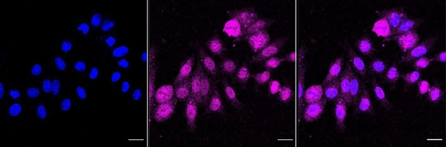 GOT2 Antibody in Immunocytochemistry (ICC/IF)
