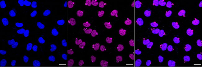 GATAD2A Antibody in Immunocytochemistry (ICC/IF)