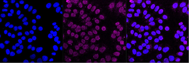 DLAT Antibody in Immunocytochemistry (ICC/IF)