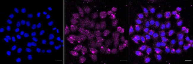 CD46 Antibody in Immunocytochemistry (ICC/IF)