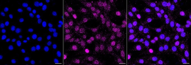 GATA3 Antibody in Immunocytochemistry (ICC/IF)
