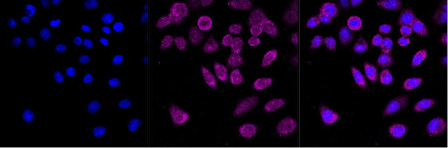 HDAC3 Antibody in Immunocytochemistry (ICC/IF)
