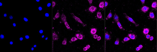GNAQ Antibody in Immunocytochemistry (ICC/IF)