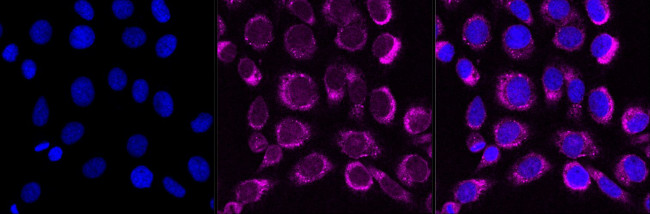 PCAF Antibody in Immunocytochemistry (ICC/IF)