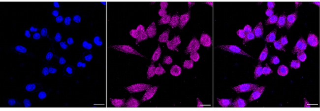 PIK3CB Antibody in Immunocytochemistry (ICC/IF)