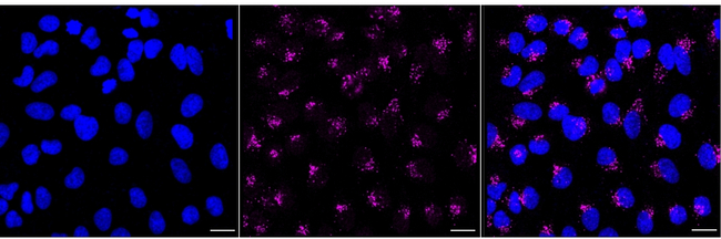 LGMN Antibody in Immunocytochemistry (ICC/IF)
