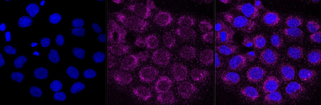 ITGB1 Antibody in Immunocytochemistry (ICC/IF)