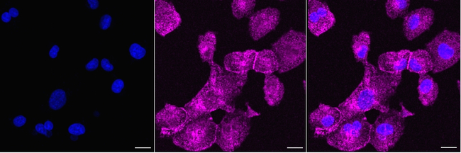 NUMB Antibody in Immunocytochemistry (ICC/IF)