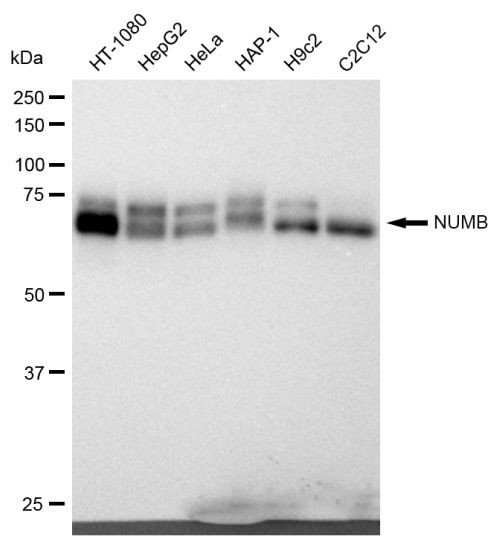 NUMB Antibody in Western Blot (WB)