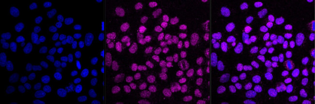 MCM7 Antibody in Immunocytochemistry (ICC/IF)