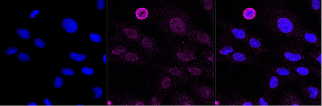 EphB4 Antibody in Immunocytochemistry (ICC/IF)