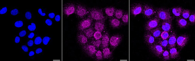 ITGB1 Antibody in Immunocytochemistry (ICC/IF)