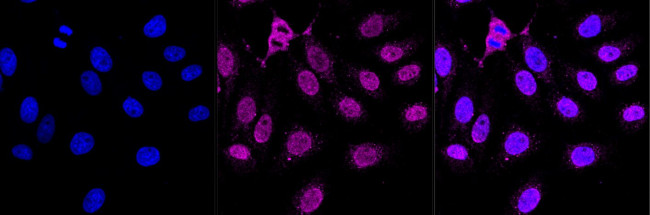 MCM7 Antibody in Immunocytochemistry (ICC/IF)