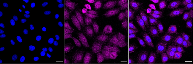 CDK4 Antibody in Immunocytochemistry (ICC/IF)