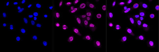 CHD3 Antibody in Immunocytochemistry (ICC/IF)