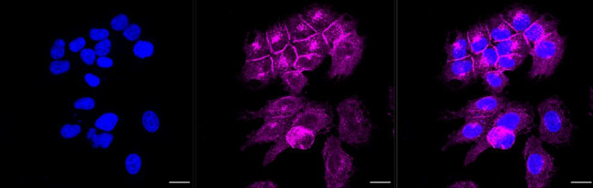 Flotillin 1 Antibody in Immunocytochemistry (ICC/IF)