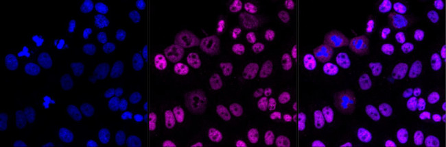 MCM7 Antibody in Immunocytochemistry (ICC/IF)