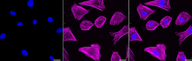 Alpha-Smooth Muscle Actin Antibody in Immunocytochemistry (ICC/IF)