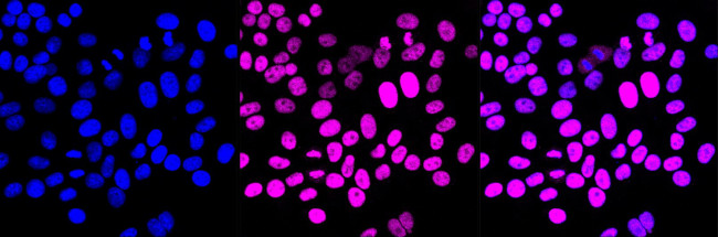 CHD3 Antibody in Immunocytochemistry (ICC/IF)