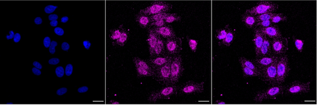 TSC2 Antibody in Immunocytochemistry (ICC/IF)