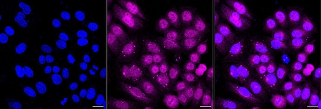 AAMP Antibody in Immunocytochemistry (ICC/IF)
