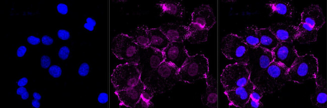 Phospho-PKR (Thr451) Antibody in Immunocytochemistry (ICC/IF)